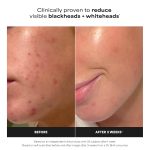 تونر پائولوز چویس مدل 2% BHA Liquid Exfoliant حجم 118 میلی لیتر - Image 3
